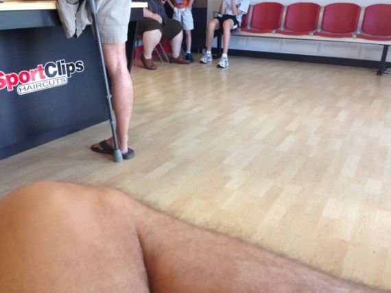 adult male leg amputee