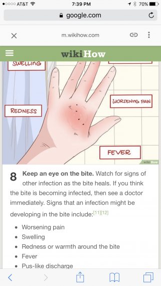 Dog bite tips